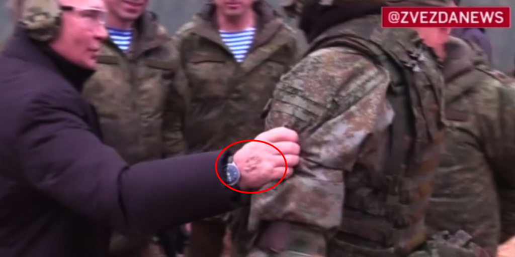 Er det stikmærker? Ny video af Putin puster til sygdomsrygter