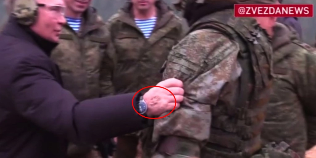 Er det stikmærker? Ny video af Putin puster til sygdomsrygter