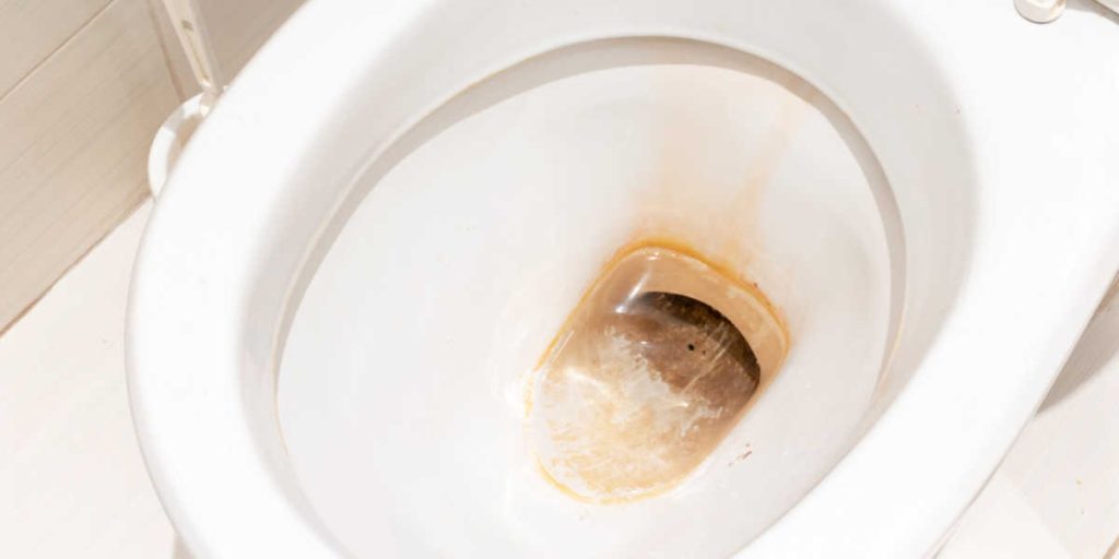 Overraskende råd: Sådan renser du toilettet for svamp og bakterier