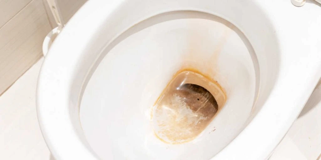 Overraskende råd: Sådan renser du toilettet for svamp og bakterier