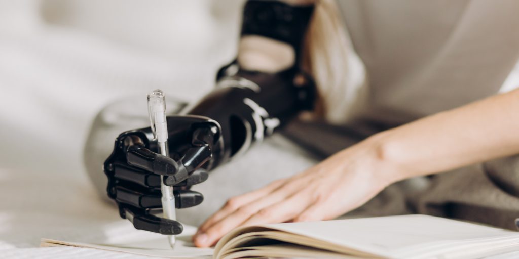 Robocop på 84 år: Kvinde bliver ældste person i verden med bionisk arm