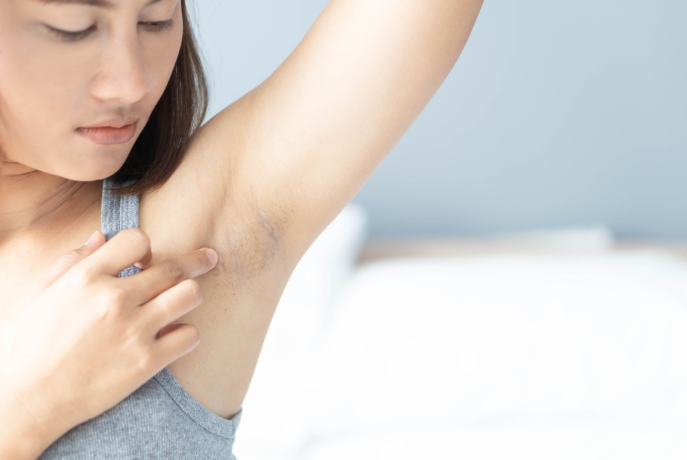 Hudlæge afslører vanvittig detalje: Har du brugt din deodorant forkert hele livet?