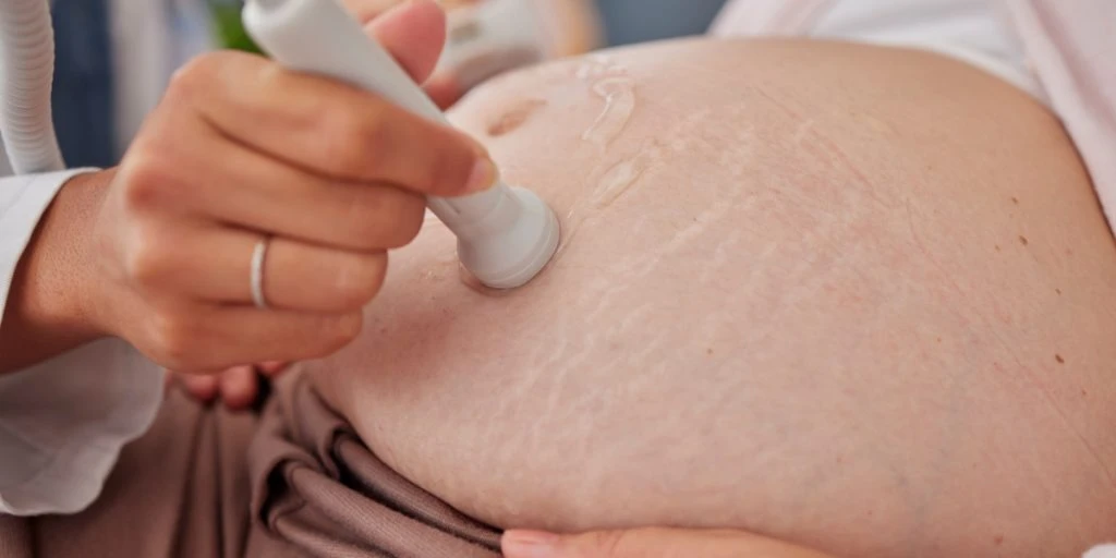 Da gravid kvinde blev scannet så lægen bekymret ud: Lægens besked slog benene væk under hende