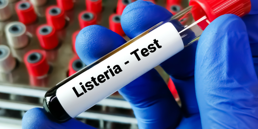 Tilbagekalder 2 slags pålæg: Der er fundet listeria