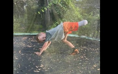 5-årig mister ben til græsslåmaskine: Hopper på trampolin et par uger efter